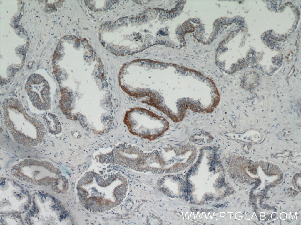 Immunohistochemistry (IHC) staining of human prostate hyperplasia tissue using HSPA2 Polyclonal antibody (12797-1-AP)