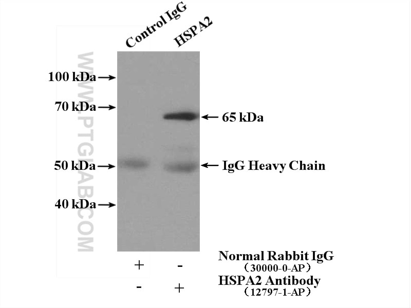 Immunoprecipitation (IP) experiment of mouse skeletal muscle tissue using HSPA2 Polyclonal antibody (12797-1-AP)