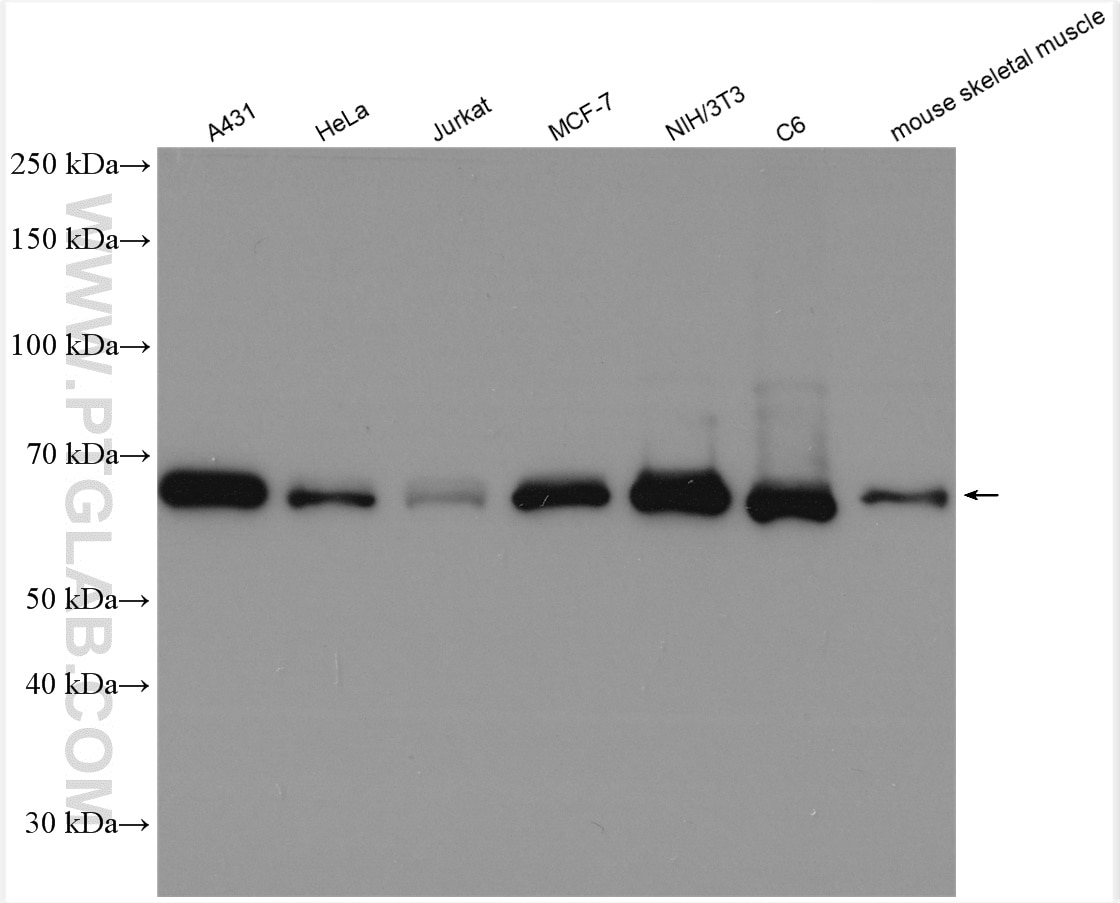 Western Blot (WB) analysis of various lysates using HSPA2 Polyclonal antibody (12797-1-AP)