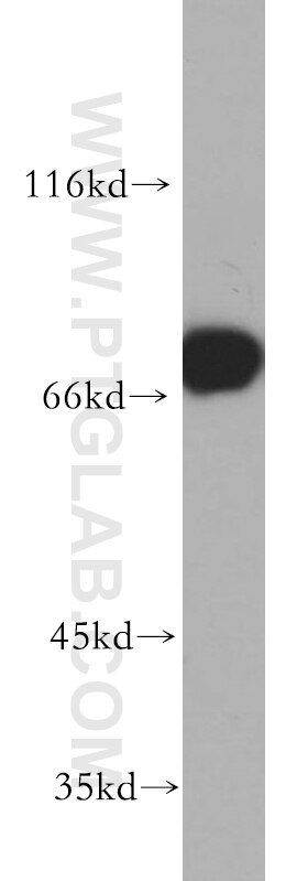 Western Blot (WB) analysis of human skeletal muscle tissue using HSPA2 Polyclonal antibody (12797-1-AP)