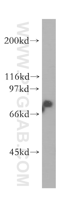 Western Blot (WB) analysis of human brain tissue using HSPA2 Polyclonal antibody (12797-1-AP)