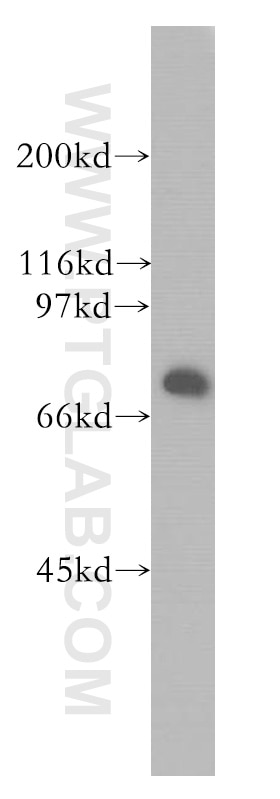 Western Blot (WB) analysis of human kidney tissue using HSPA2 Polyclonal antibody (12797-1-AP)