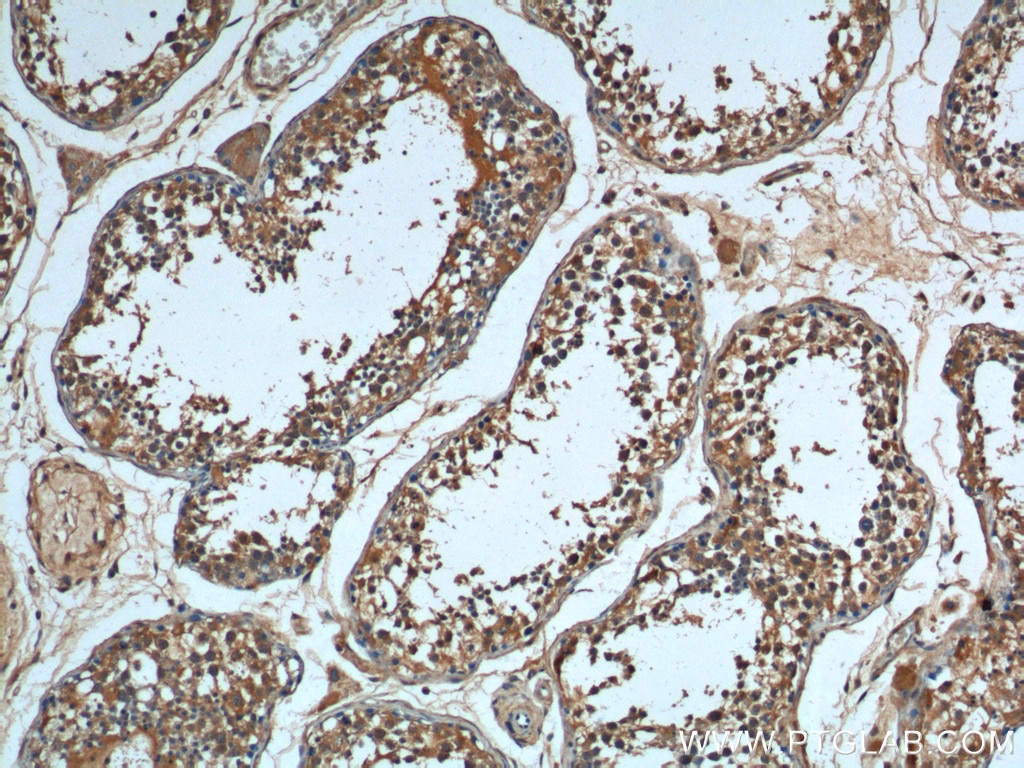 Immunohistochemistry (IHC) staining of human testis tissue using HSPA2 Monoclonal antibody (66291-1-Ig)