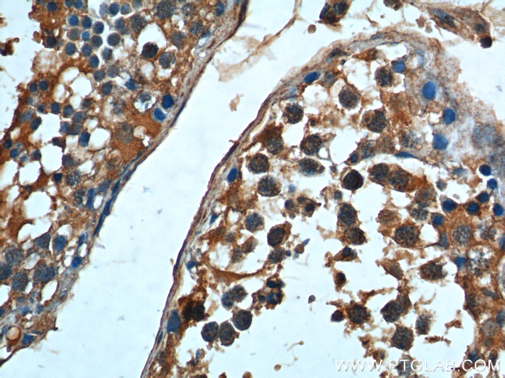 Immunohistochemistry (IHC) staining of human testis tissue using HSPA2 Monoclonal antibody (66291-1-Ig)