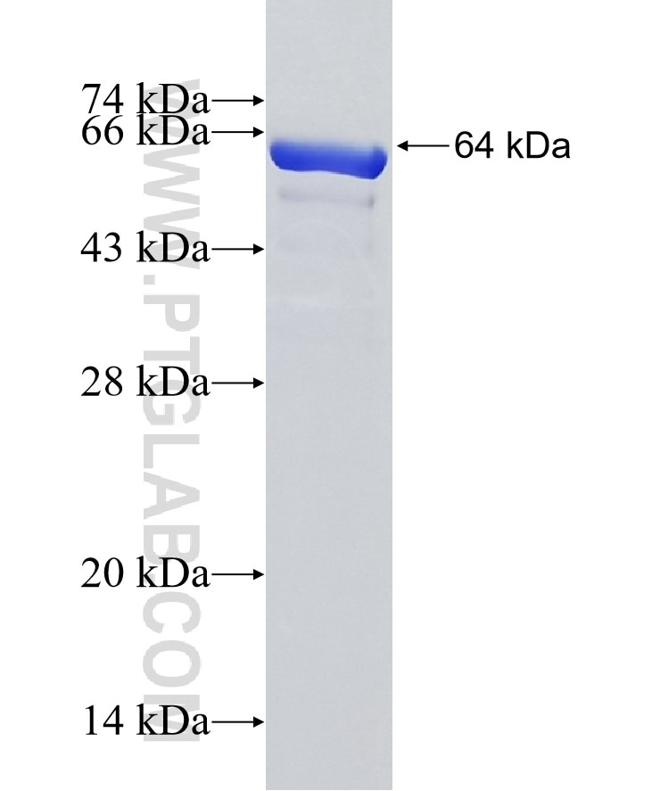 HSPA2 fusion protein Ag3539 SDS-PAGE