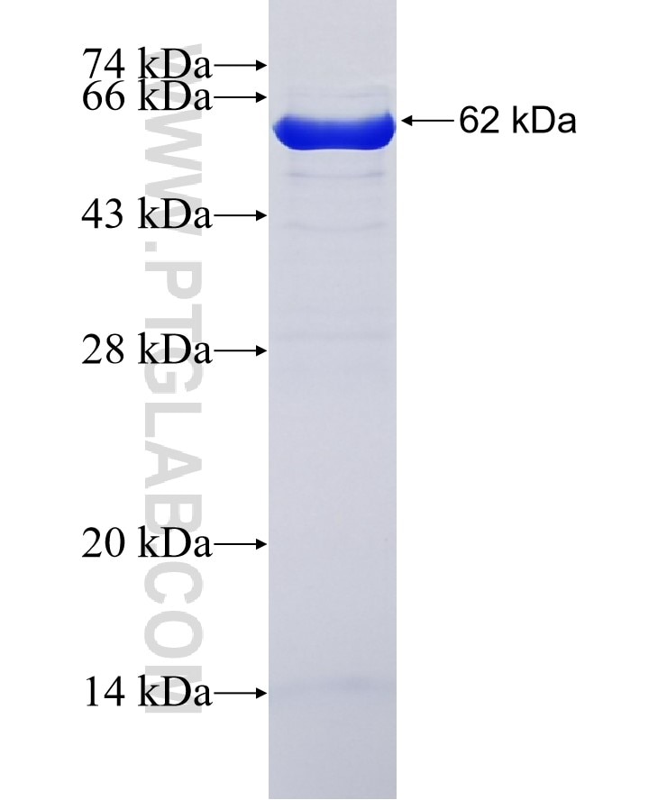 HSPA2 fusion protein Ag3539 SDS-PAGE