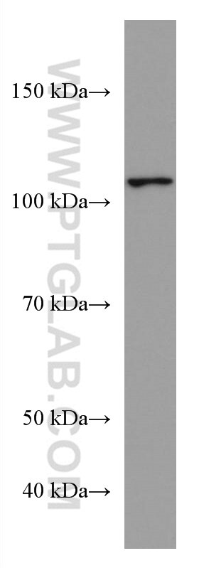 Western Blot (WB) analysis of pig brain tissue using HSPA4 Monoclonal antibody (67173-1-Ig)