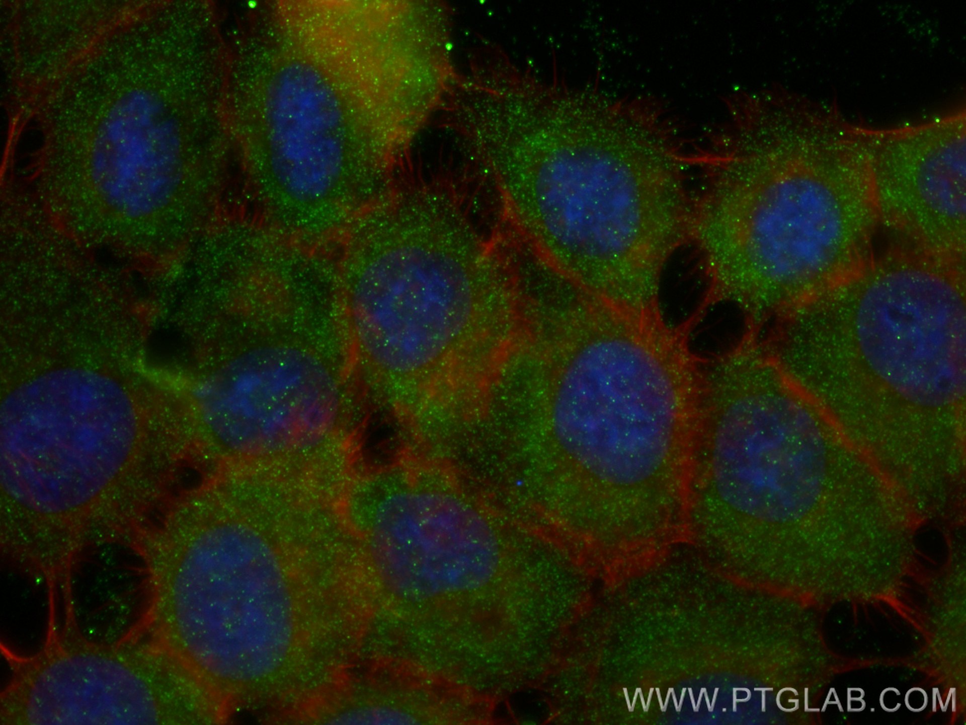 Immunofluorescence (IF) / fluorescent staining of A431 cells using HSPA6 Monoclonal antibody (68257-1-Ig)