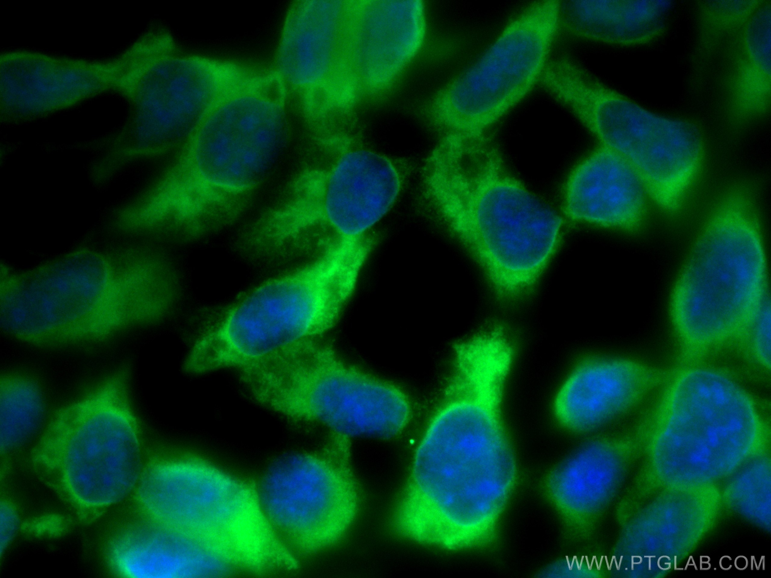 Immunofluorescence (IF) / fluorescent staining of HEK-293 cells using Hsc70 Polyclonal antibody (10654-1-AP)