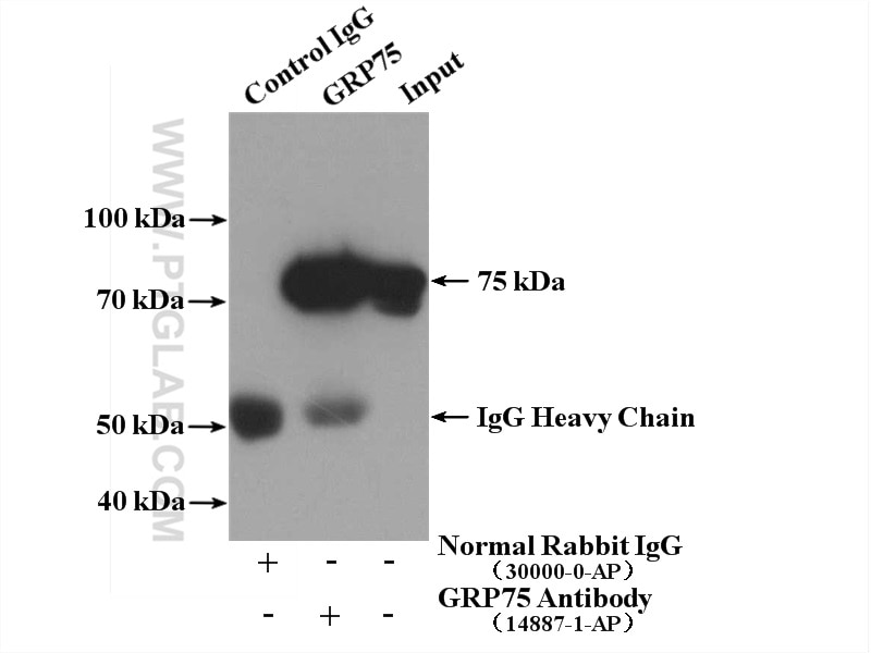 Immunoprecipitation (IP) experiment of mouse brain tissue using GRP75 Polyclonal antibody (14887-1-AP)