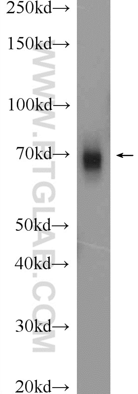 Western Blot (WB) analysis of mouse testis tissue using GRP75 Polyclonal antibody (14887-1-AP)