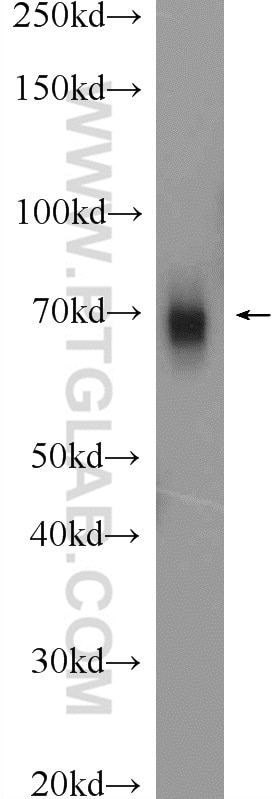 WB analysis of mouse testis using 14887-1-AP