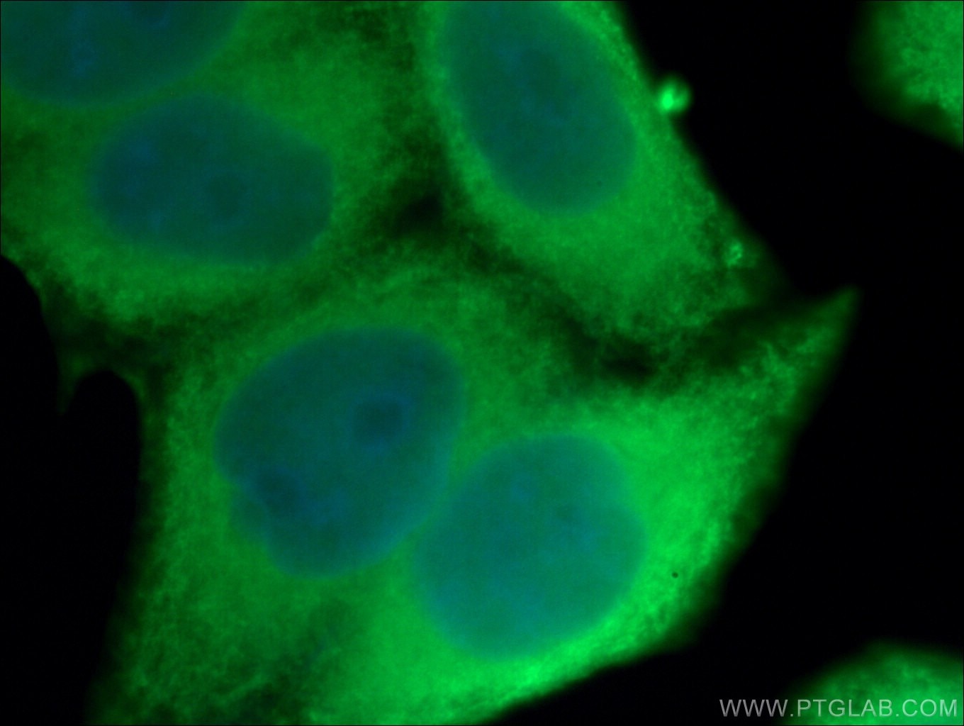 IF Staining of HeLa using 18284-1-AP