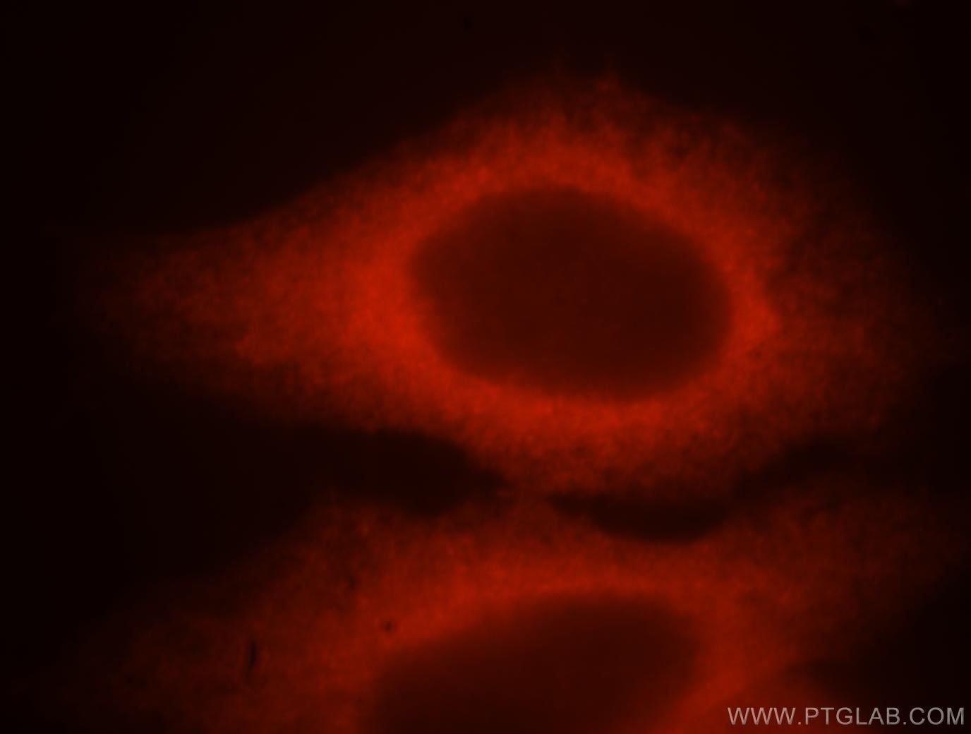 Immunofluorescence (IF) / fluorescent staining of MCF-7 cells using HSP27 Polyclonal antibody (18284-1-AP)