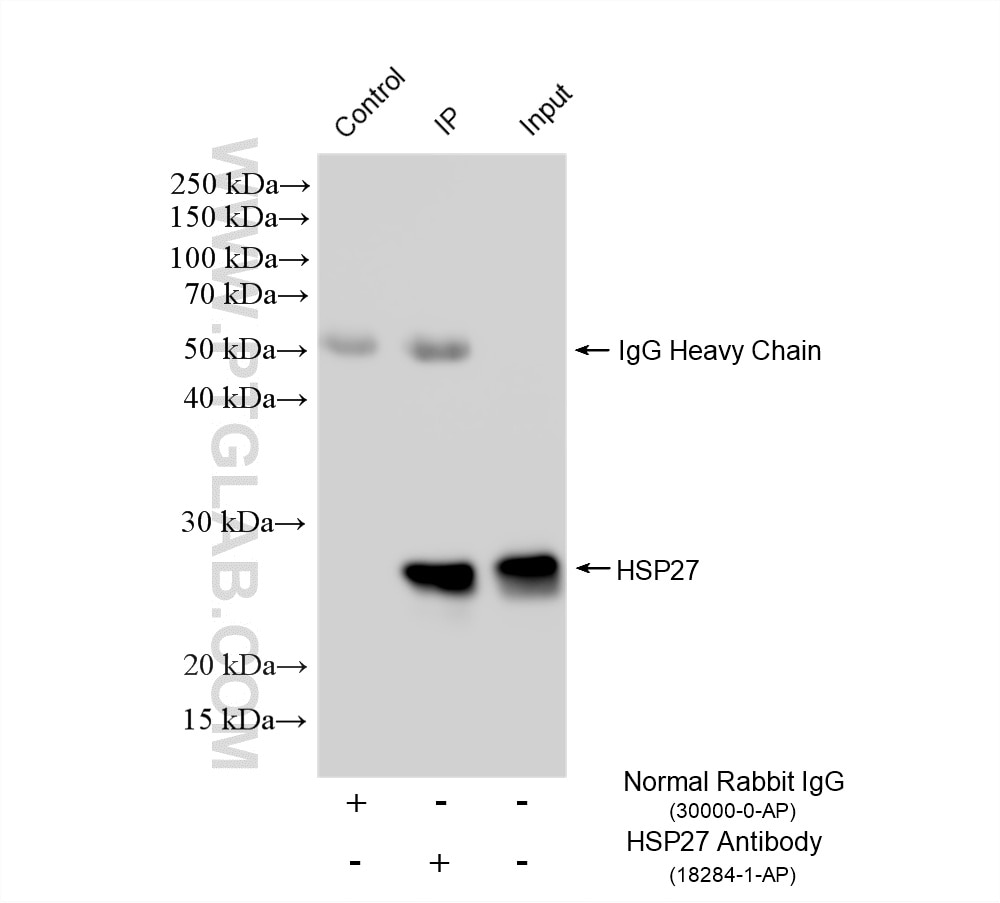 Immunoprecipitation (IP) experiment of A549 cells using HSP27 Polyclonal antibody (18284-1-AP)
