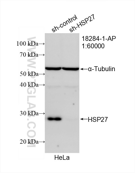 Western Blot (WB) analysis of HeLa cells using HSP27 Polyclonal antibody (18284-1-AP)