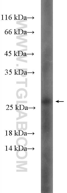 Western Blot (WB) analysis of C6 cells using HSP27 Polyclonal antibody (18284-1-AP)