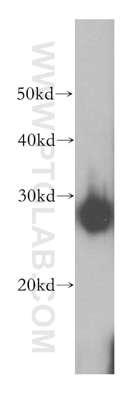 HSP27 Polyclonal antibody