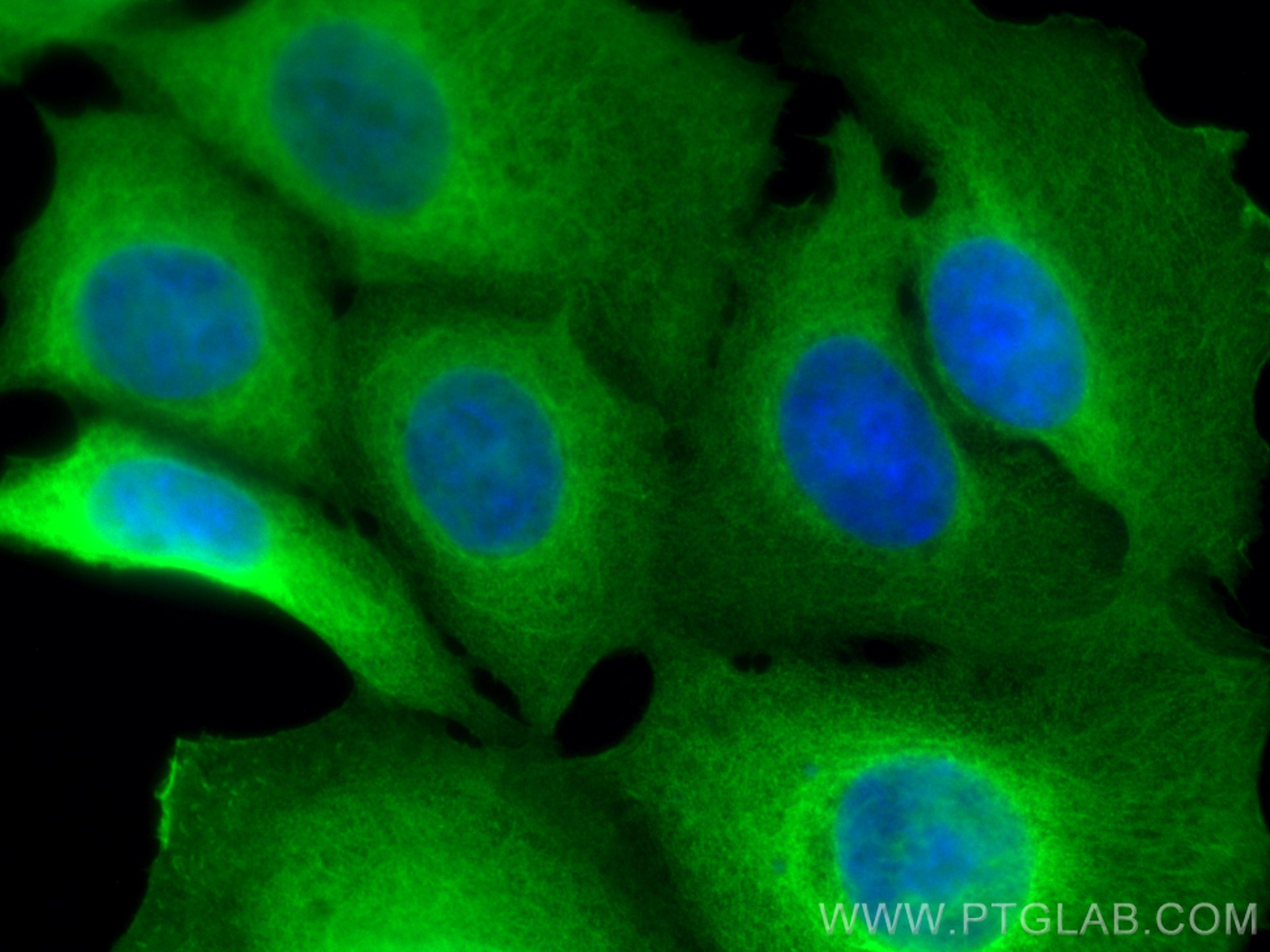 Immunofluorescence (IF) / fluorescent staining of MCF-7 cells using HSP27 Monoclonal antibody (66767-1-Ig)