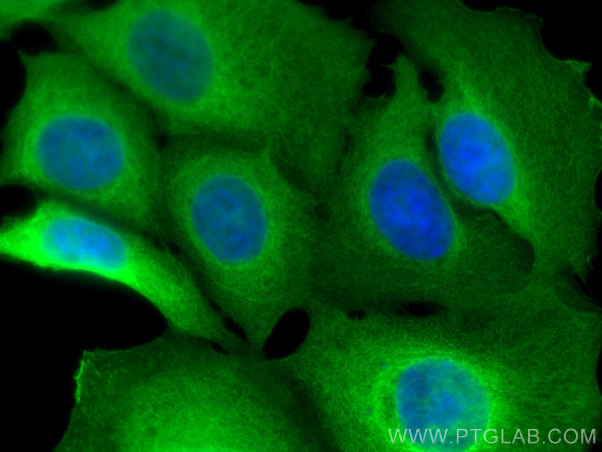 IF Staining of MCF-7 using 66767-1-Ig