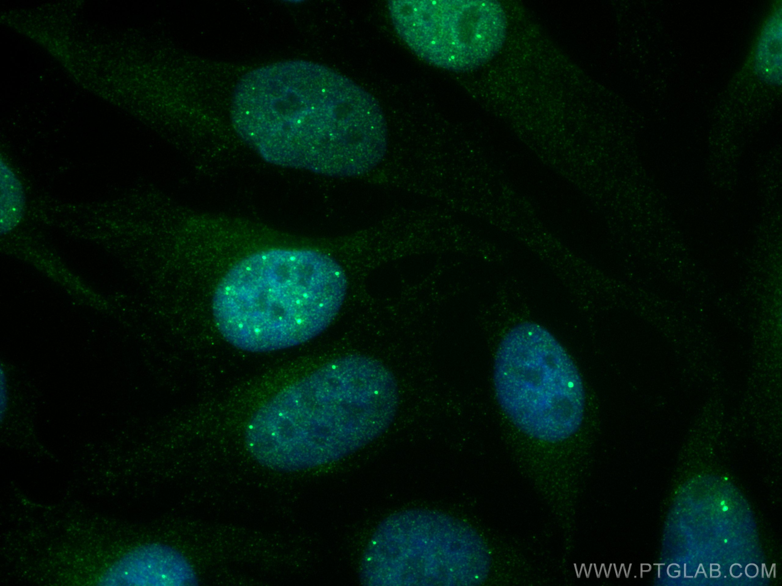 Immunofluorescence (IF) / fluorescent staining of HeLa cells using HSPB3 Monoclonal antibody (67890-1-Ig)