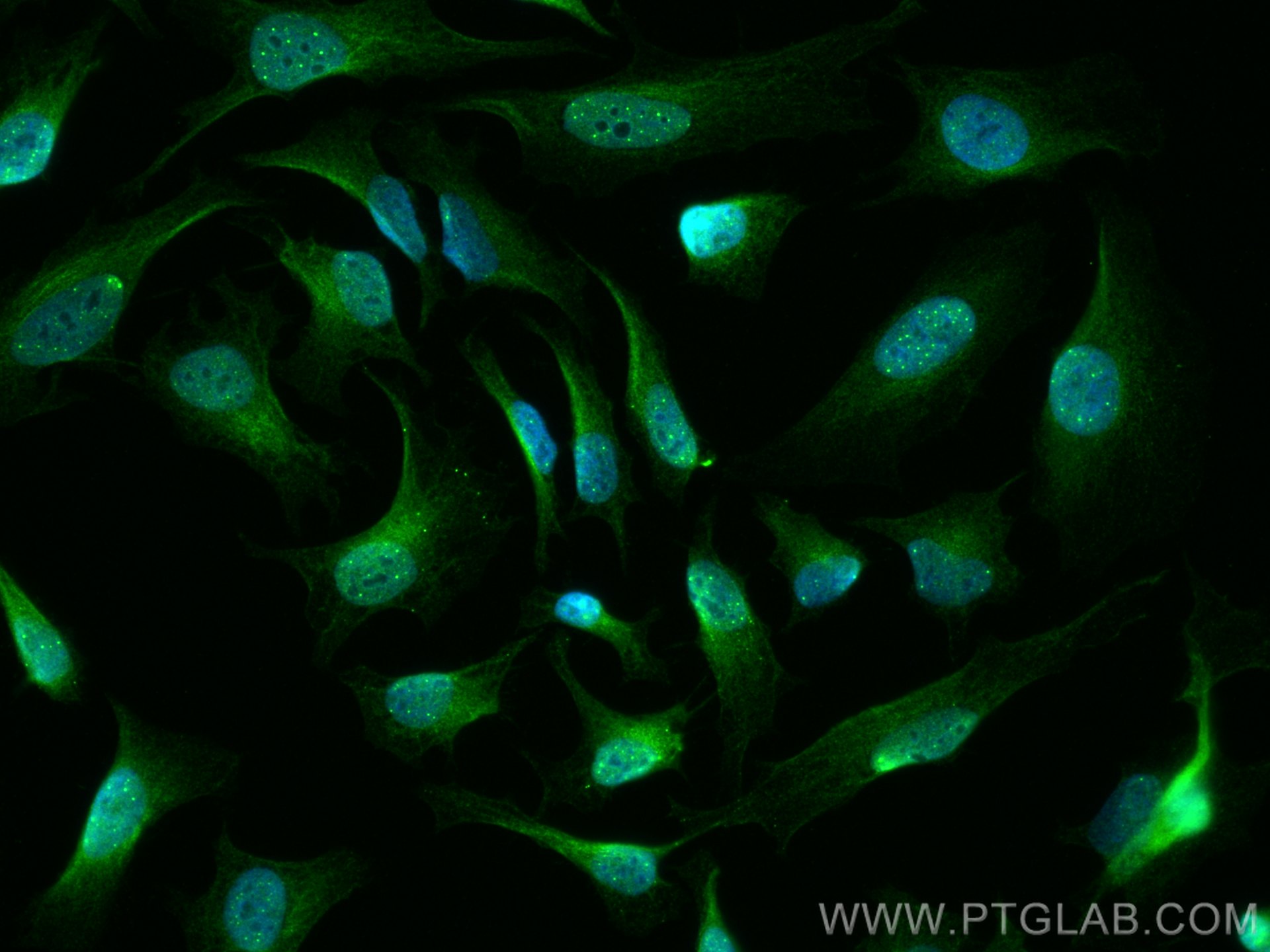 Immunofluorescence (IF) / fluorescent staining of HeLa cells using HSPB3 Monoclonal antibody (67890-1-Ig)