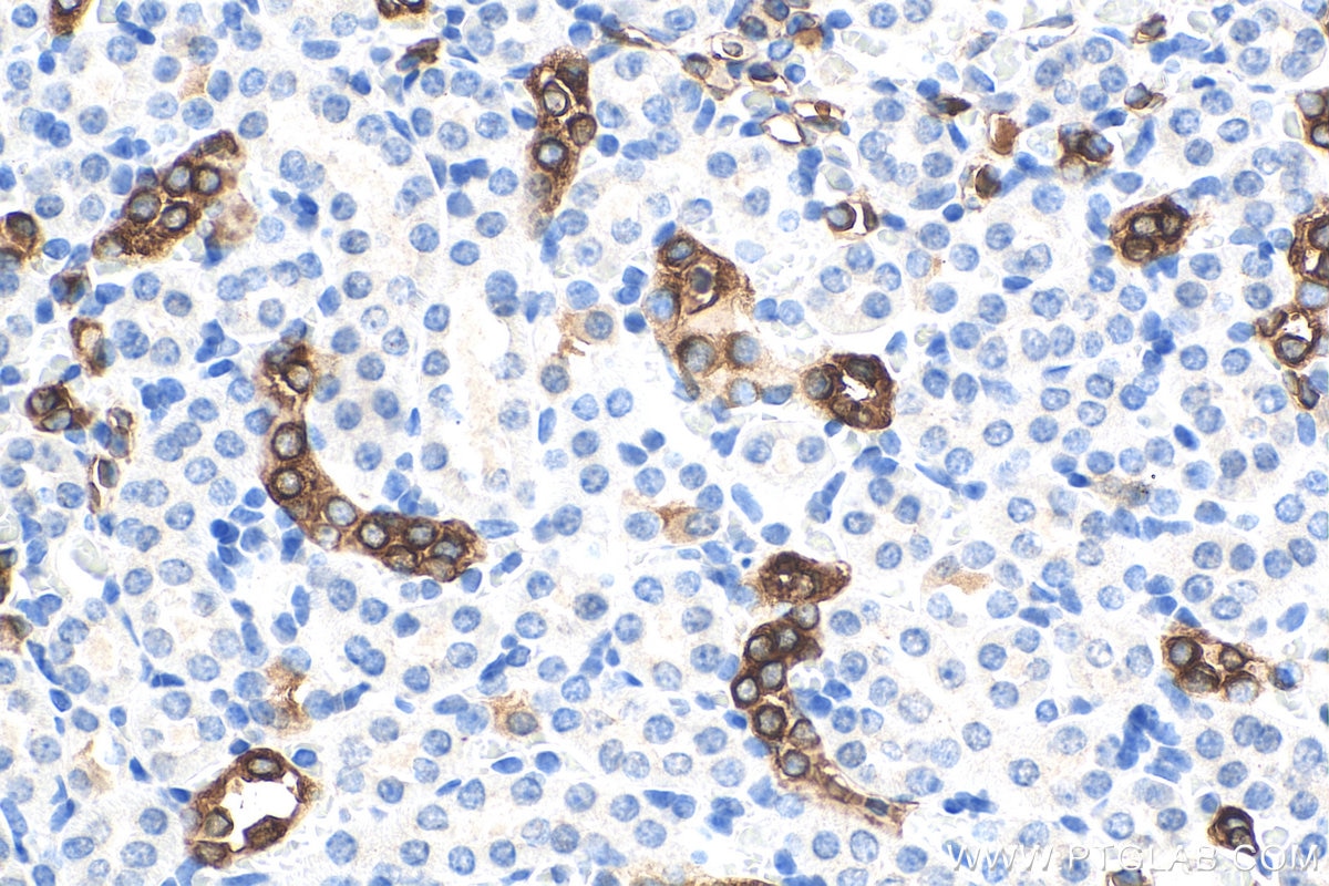 Immunohistochemistry (IHC) staining of mouse kidney tissue using HSPB3 Monoclonal antibody (67890-1-Ig)