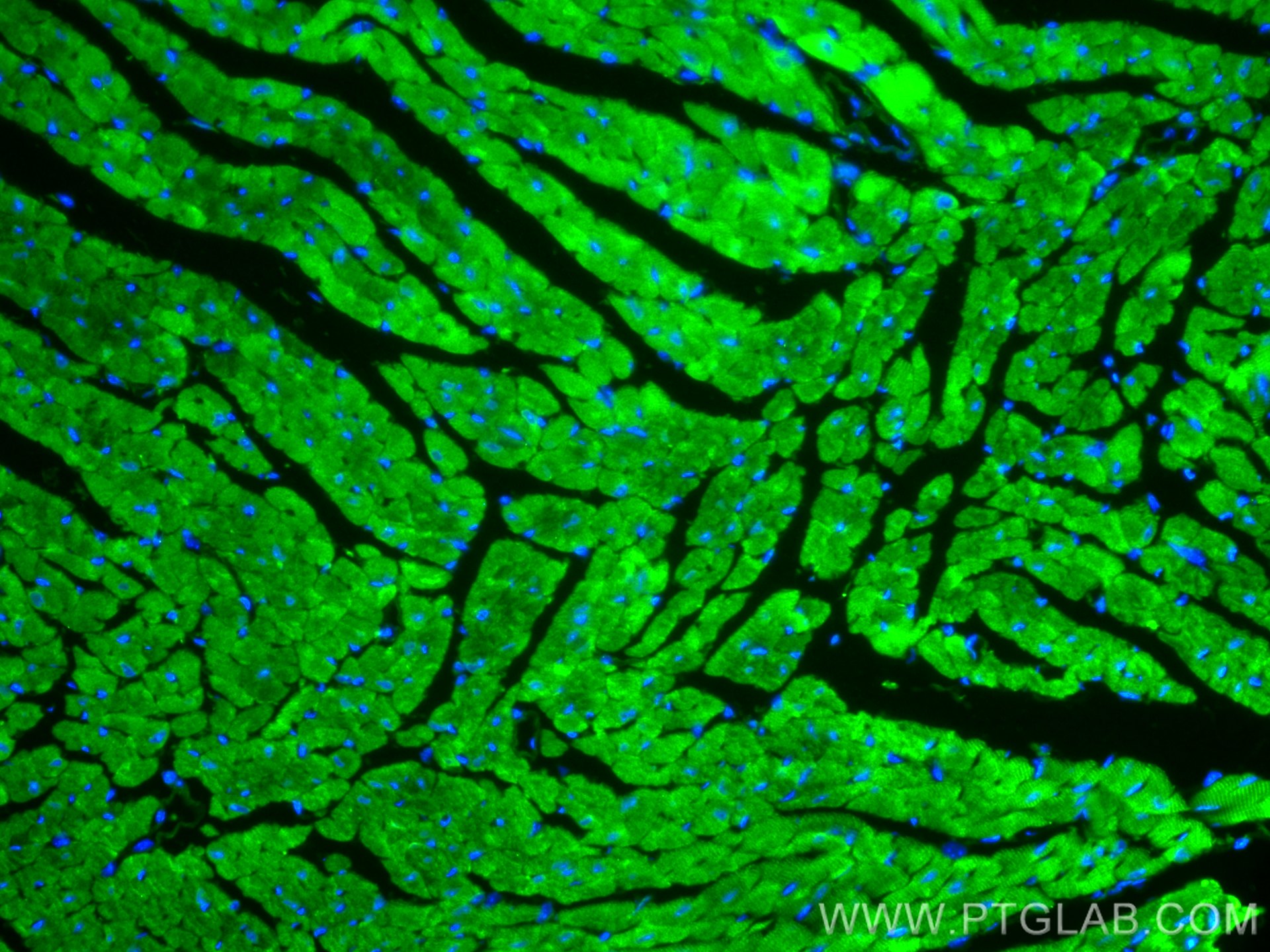 Immunofluorescence (IF) / fluorescent staining of mouse heart tissue using HSP20 Polyclonal antibody (16813-1-AP)