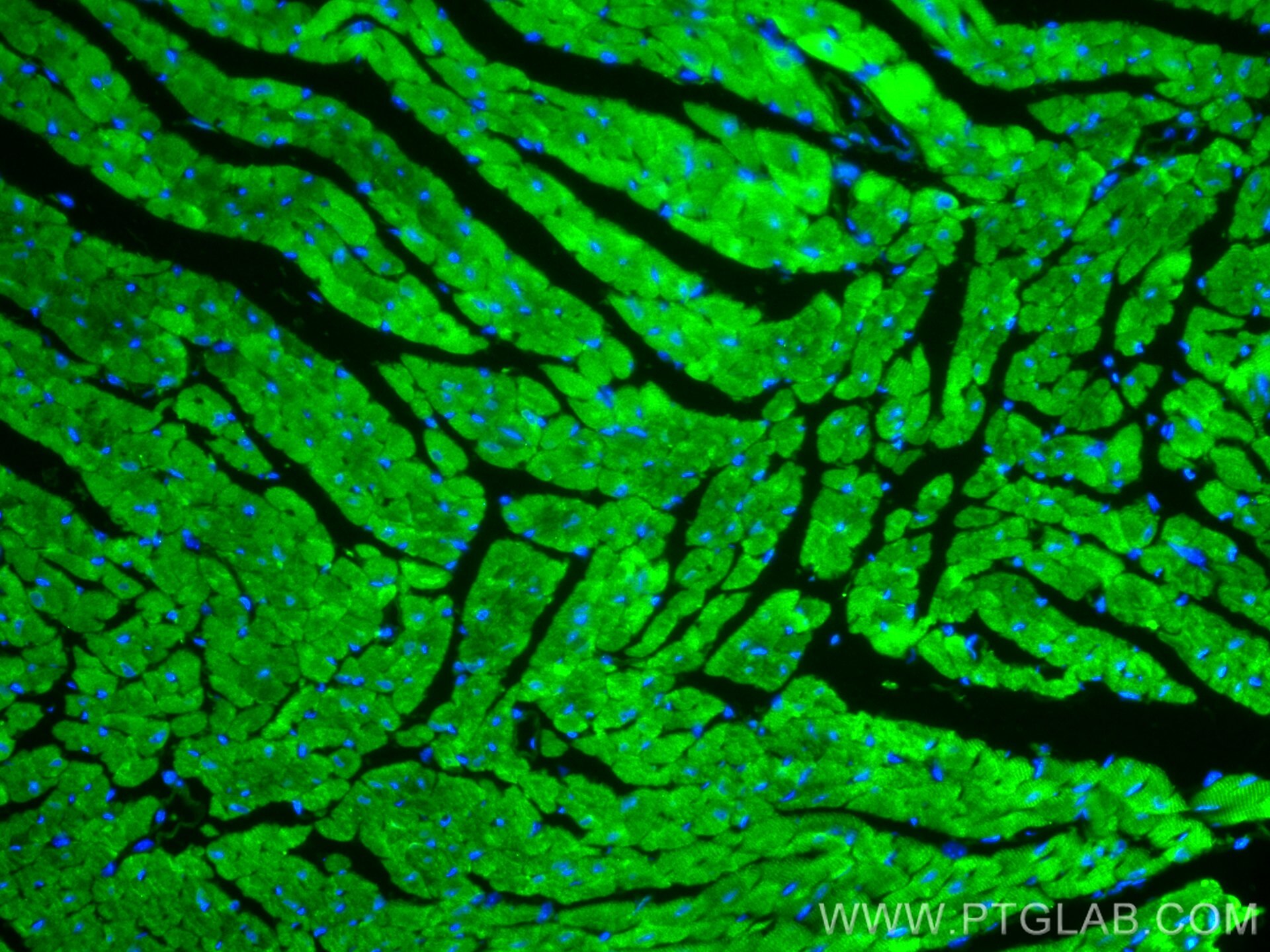 IF Staining of mouse heart using 16813-1-AP