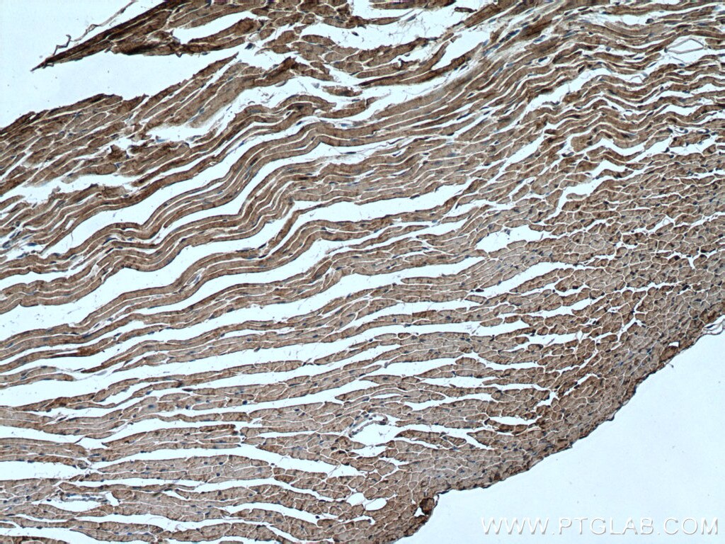 Immunohistochemistry (IHC) staining of mouse heart tissue using HSP20 Polyclonal antibody (16813-1-AP)