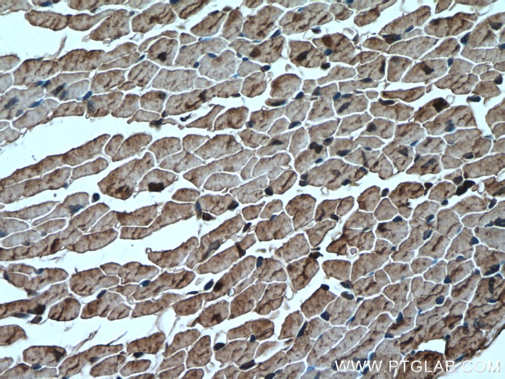 Immunohistochemistry (IHC) staining of mouse heart tissue using HSP20 Polyclonal antibody (16813-1-AP)