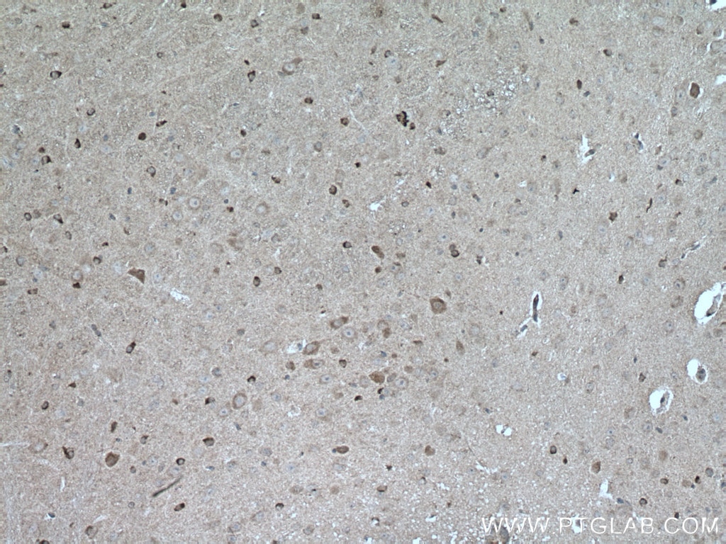IHC staining of mouse brain using 16813-1-AP