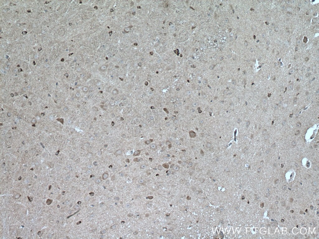 Immunohistochemistry (IHC) staining of mouse brain tissue using HSP20 Polyclonal antibody (16813-1-AP)