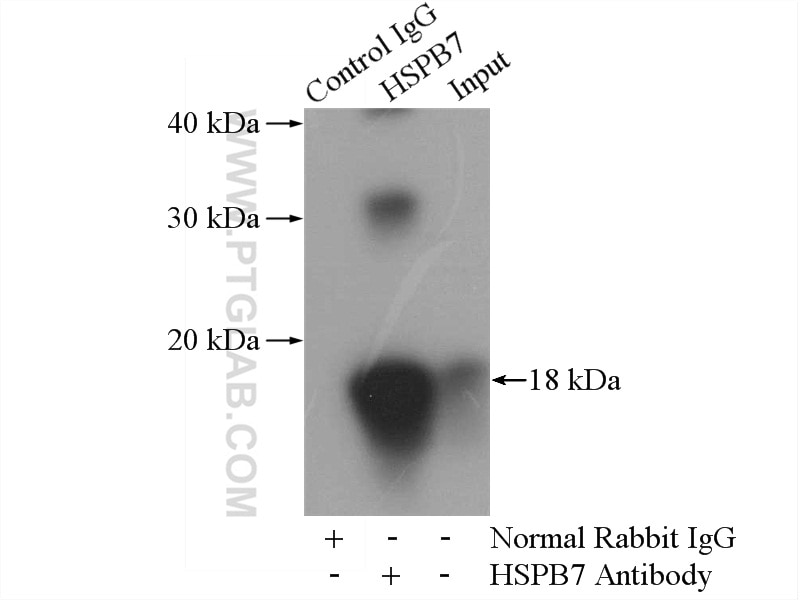 Immunoprecipitation (IP) experiment of mouse skeletal muscle tissue using HSPB7 Polyclonal antibody (15700-1-AP)