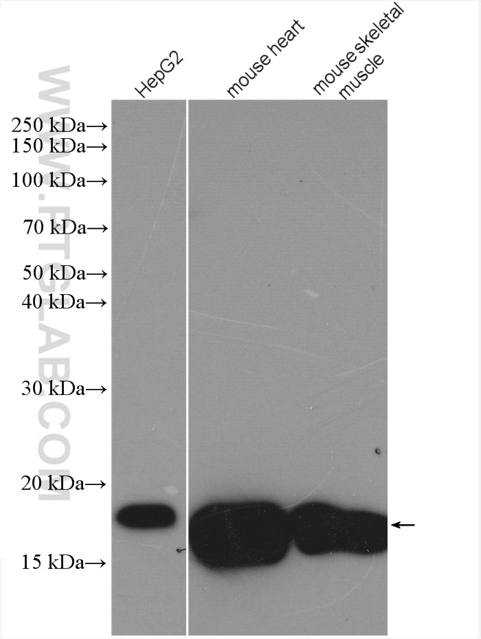 Western Blot (WB) analysis of various lysates using HSPB7 Polyclonal antibody (15700-1-AP)