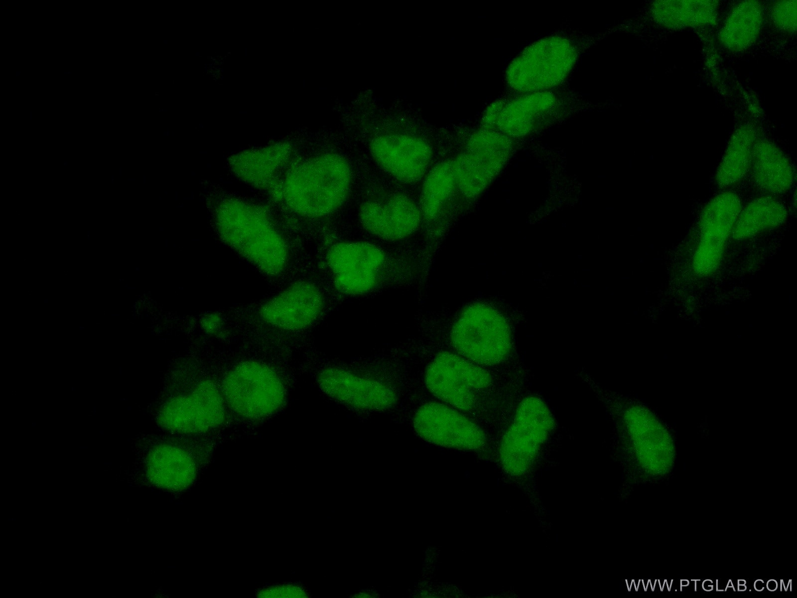 Immunofluorescence (IF) / fluorescent staining of HEK-293 cells using HSPB8 Polyclonal antibody (15287-1-AP)