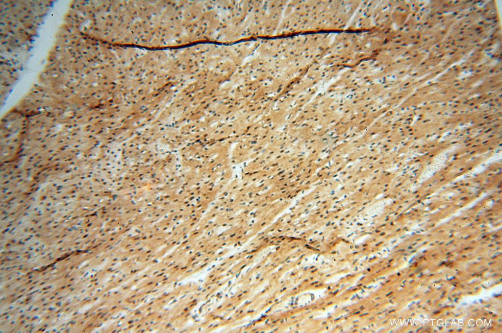 Immunohistochemistry (IHC) staining of human heart tissue using HSPB8 Polyclonal antibody (15287-1-AP)