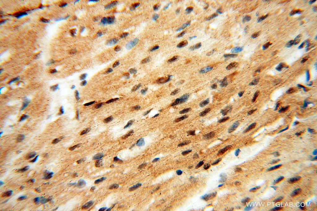 Immunohistochemistry (IHC) staining of human heart tissue using HSPB8 Polyclonal antibody (15287-1-AP)