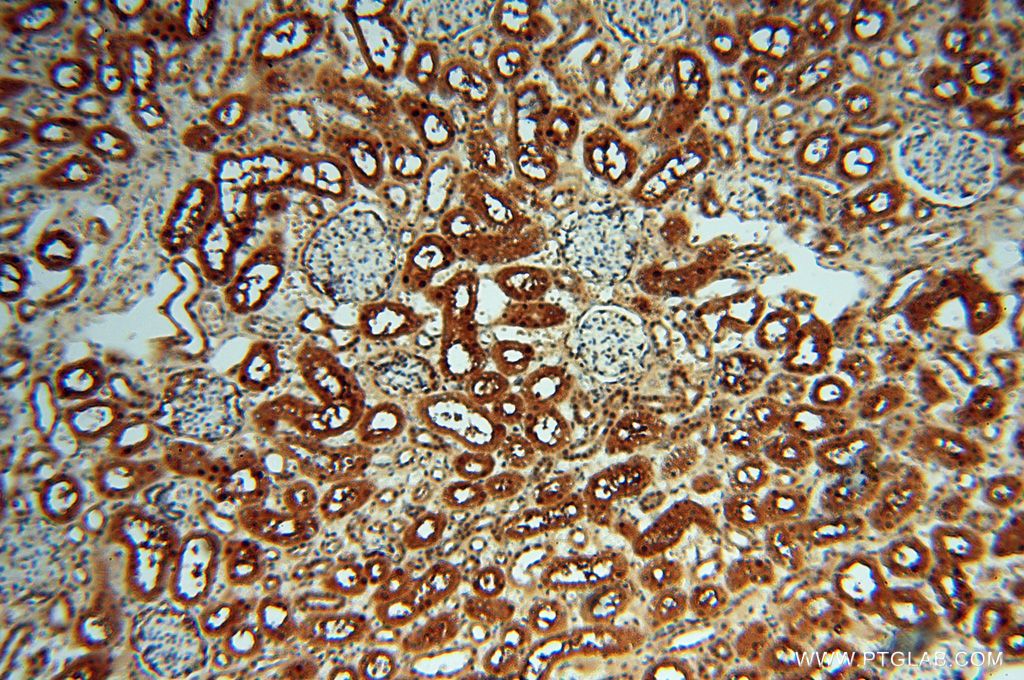 Immunohistochemistry (IHC) staining of human kidney tissue using HSPB8 Polyclonal antibody (15287-1-AP)