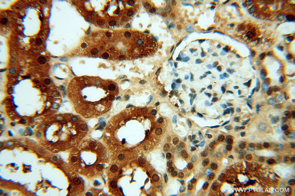 Immunohistochemistry (IHC) staining of human kidney tissue using HSPB8 Polyclonal antibody (15287-1-AP)