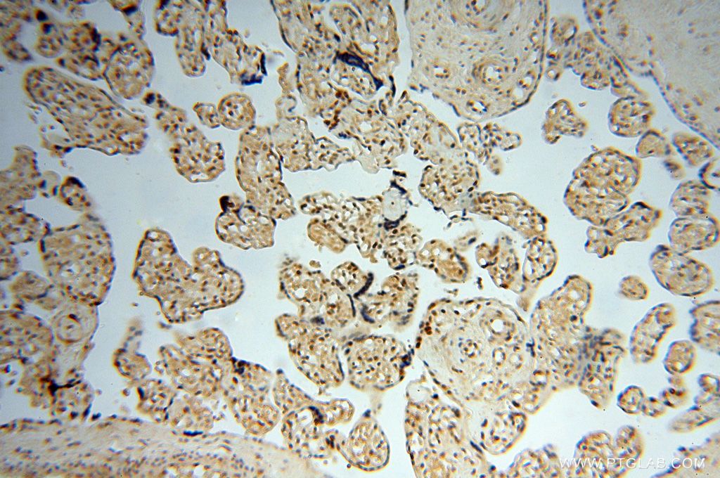 Immunohistochemistry (IHC) staining of human placenta tissue using HSPB8 Polyclonal antibody (15287-1-AP)