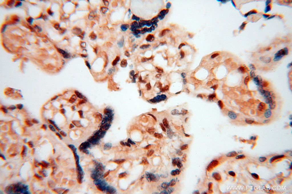 Immunohistochemistry (IHC) staining of human placenta tissue using HSPB8 Polyclonal antibody (15287-1-AP)