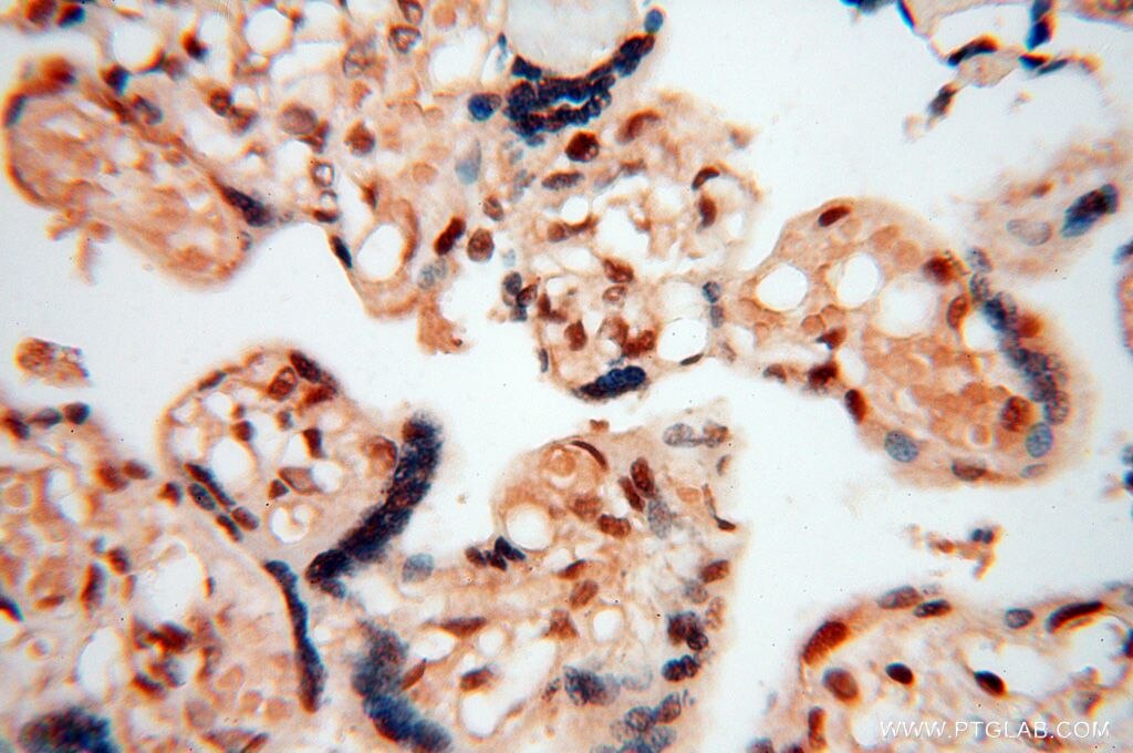 IHC staining of human placenta using 15287-1-AP