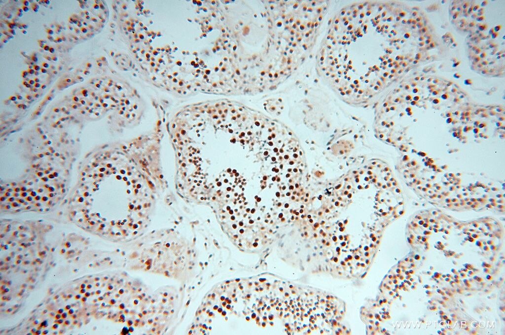 Immunohistochemistry (IHC) staining of human testis tissue using HSPB8 Polyclonal antibody (15287-1-AP)