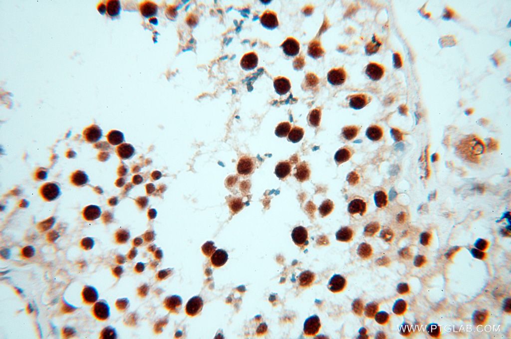 Immunohistochemistry (IHC) staining of human testis tissue using HSPB8 Polyclonal antibody (15287-1-AP)