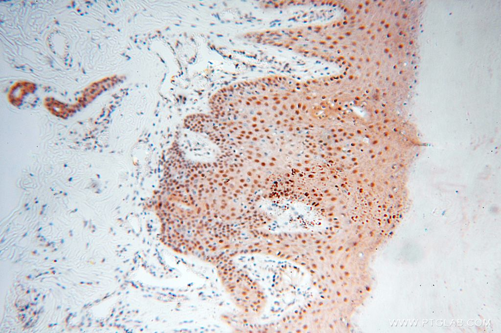 Immunohistochemistry (IHC) staining of human skin tissue using HSPB8 Polyclonal antibody (15287-1-AP)