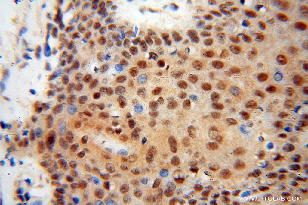 Immunohistochemistry (IHC) staining of human skin tissue using HSPB8 Polyclonal antibody (15287-1-AP)