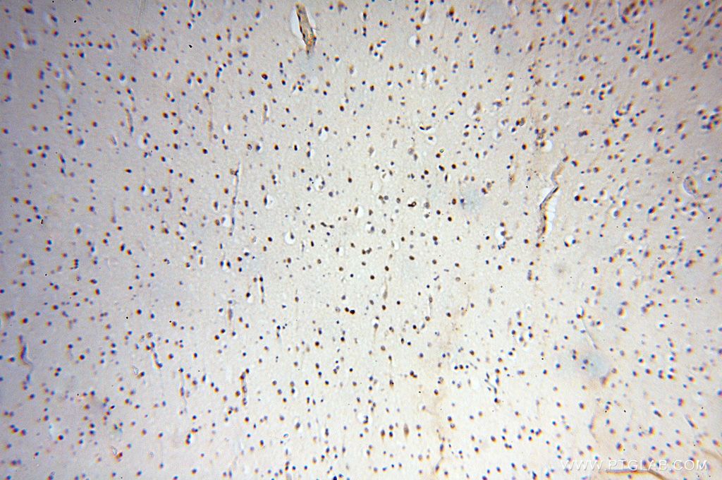 IHC staining of human brain using 15287-1-AP