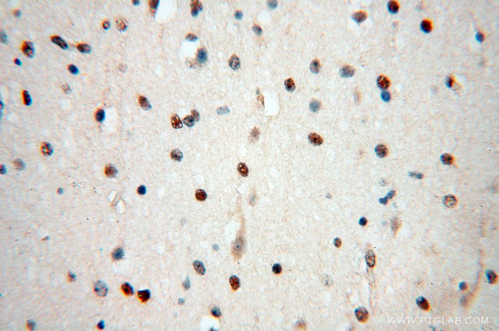 Immunohistochemistry (IHC) staining of human brain tissue using HSPB8 Polyclonal antibody (15287-1-AP)