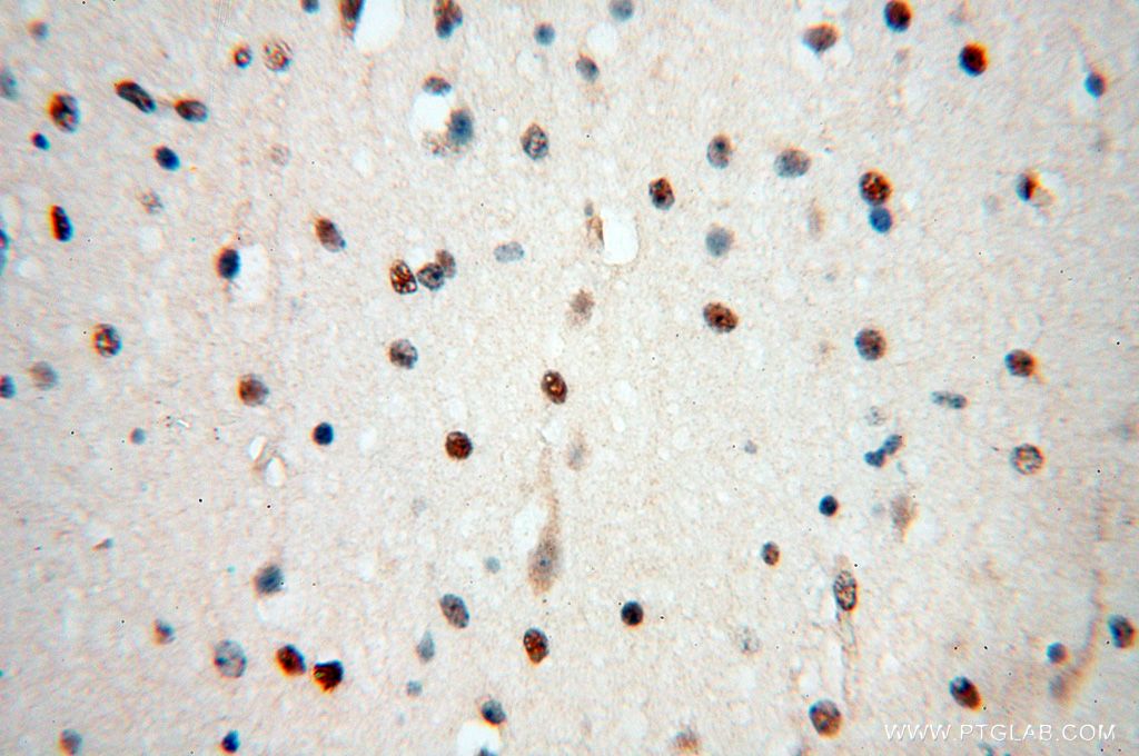 IHC staining of human brain using 15287-1-AP